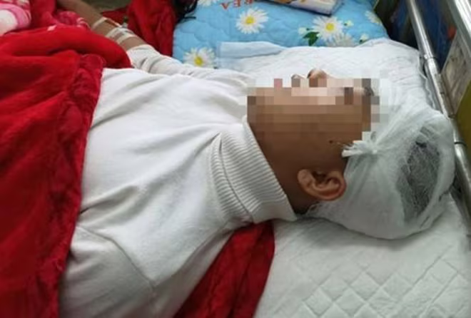 Nạn nhân bị bạn học cùng trường đánh vỡ sọ não Nạn nhân bị bạn học cùng trường đánh vỡ sọ não