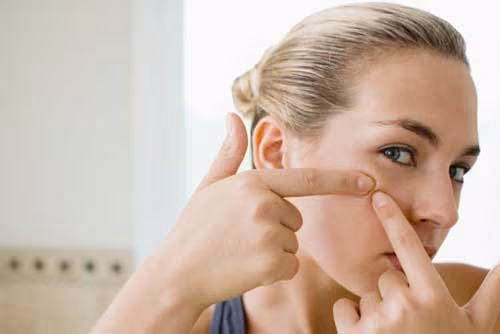 Những cách đơn giản để làm mờ sẹo ảnh 1 Những cách đơn giản để làm mờ sẹo ảnh 1