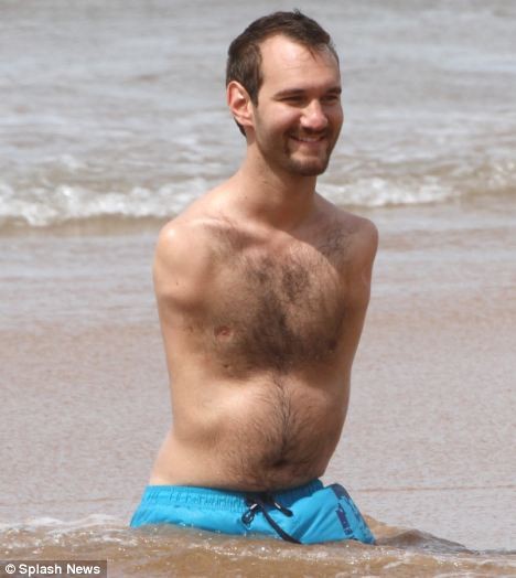 Nick Vujicic- chàng trai không tay, không chân đã lấy vợ ảnh 3 Nick Vujicic- chàng trai không tay, không chân đã lấy vợ ảnh 3