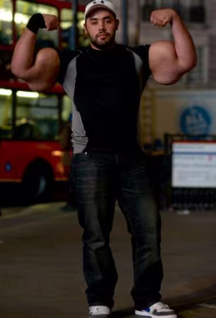 Người có bắp tay còn to hơn cả thủy thủ Popeye ảnh 1 Người có bắp tay còn to hơn cả thủy thủ Popeye ảnh 1