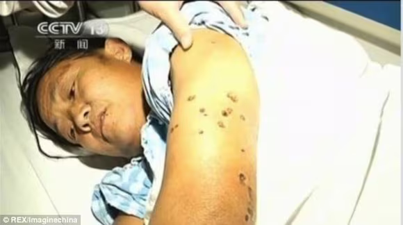 Kinh sợ loài ong khổng lồ, cực độc khiến 42 người vong mạng ảnh 2