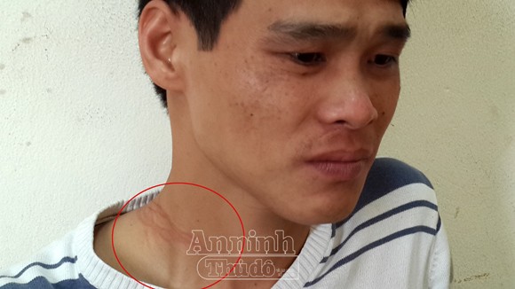 “Ngáo đá” vác dao nhảy xuống sông Hồng vì ảo giác có người đang rượt đuổi ảnh 2 “Ngáo đá” vác dao nhảy xuống sông Hồng vì ảo giác có người đang rượt đuổi ảnh 2
