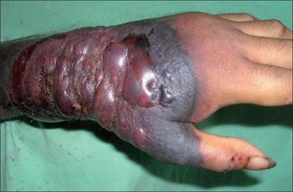 Những hình ảnh khủng khiếp về dịch bệnh Ebola ảnh 6 Những hình ảnh khủng khiếp về dịch bệnh Ebola ảnh 6