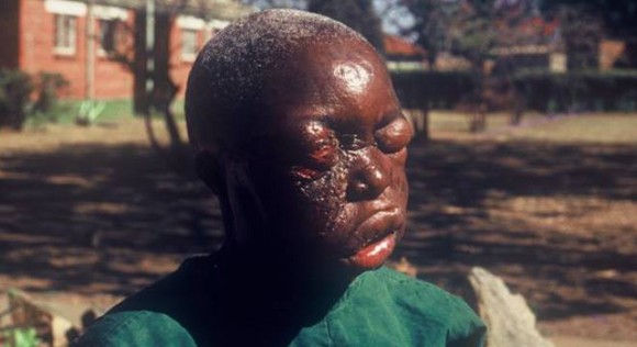 Những hình ảnh khủng khiếp về dịch bệnh Ebola ảnh 7 Những hình ảnh khủng khiếp về dịch bệnh Ebola ảnh 7