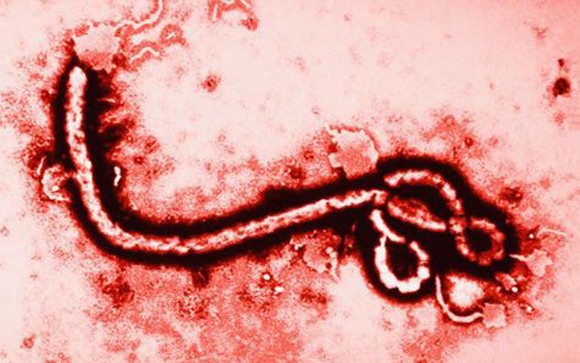 Những hình ảnh khủng khiếp về dịch bệnh Ebola ảnh 1 Những hình ảnh khủng khiếp về dịch bệnh Ebola ảnh 1
