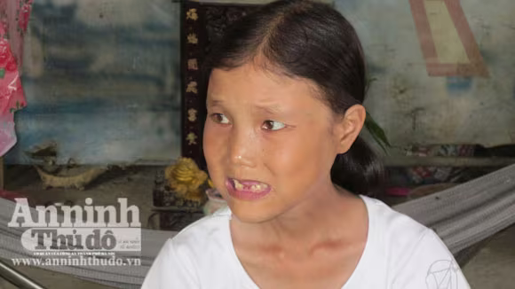 Mới 25 tuổi nhưng Như Ý đã rụng khoảng 10 chiếc răng, rất hom hem Mới 25 tuổi nhưng Như Ý đã rụng khoảng 10 chiếc răng, rất hom hem