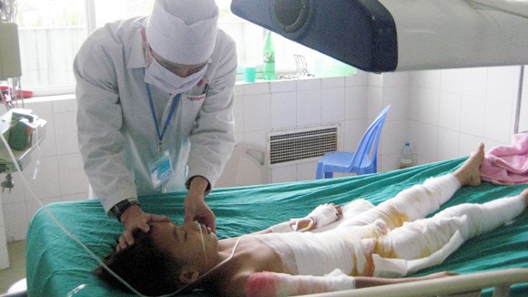 Nhiều trẻ nguy kịch vì bỏng ảnh 1 Nhiều trẻ nguy kịch vì bỏng ảnh 1