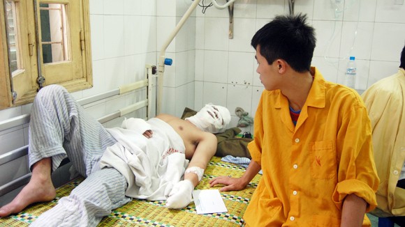 Nhiều trẻ nguy kịch vì bỏng ảnh 2 Nhiều trẻ nguy kịch vì bỏng ảnh 2
