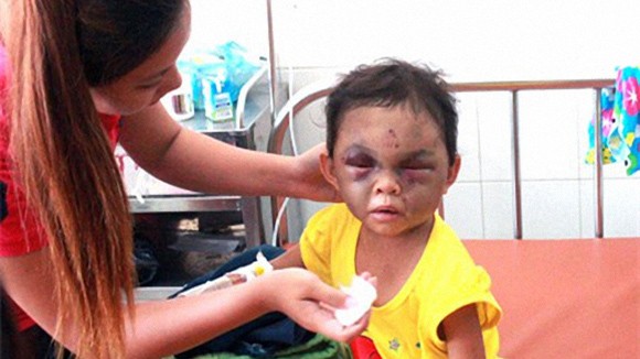 “Không thể để người mẹ dã man được nuôi con nữa” ảnh 1 “Không thể để người mẹ dã man được nuôi con nữa” ảnh 1