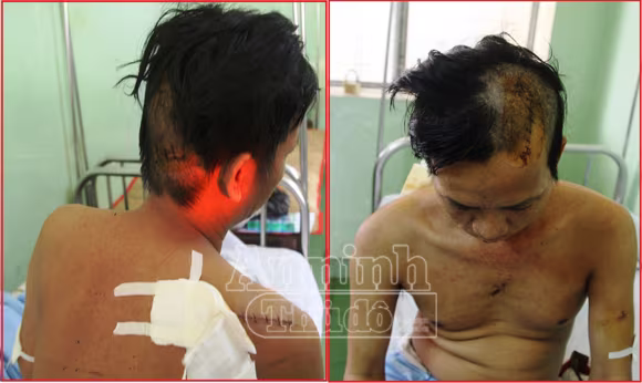 5 thanh niên vô cớ truy sát dã man người đàn ông trong đêm ảnh 1 5 thanh niên vô cớ truy sát dã man người đàn ông trong đêm ảnh 1