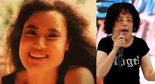Những thảm họa kinh hoàng từ phẫu thuật thẩm mỹ ảnh 2 Những thảm họa kinh hoàng từ phẫu thuật thẩm mỹ ảnh 2