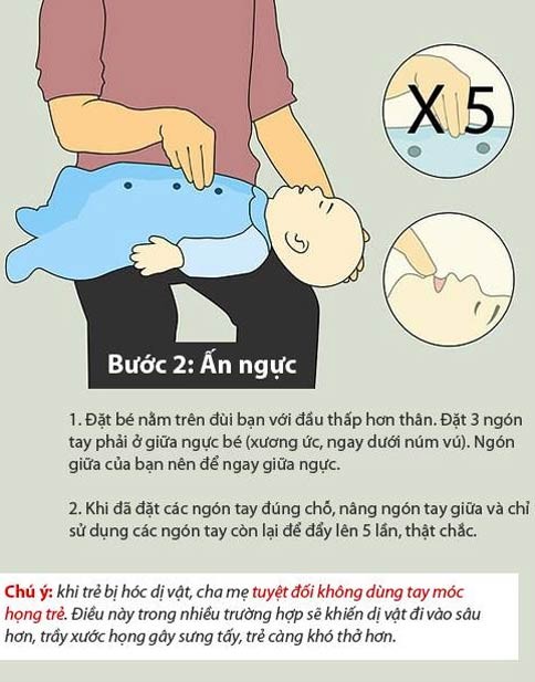 Báo động tình trạng hóc dị vật ở trẻ em ảnh 4 Báo động tình trạng hóc dị vật ở trẻ em ảnh 4