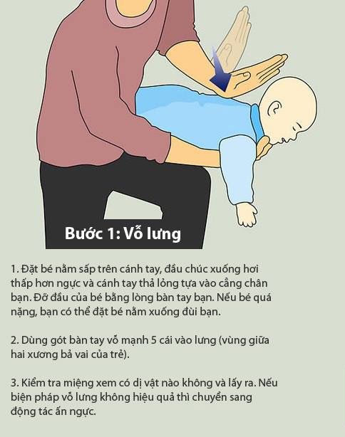 Báo động tình trạng hóc dị vật ở trẻ em ảnh 3 Báo động tình trạng hóc dị vật ở trẻ em ảnh 3