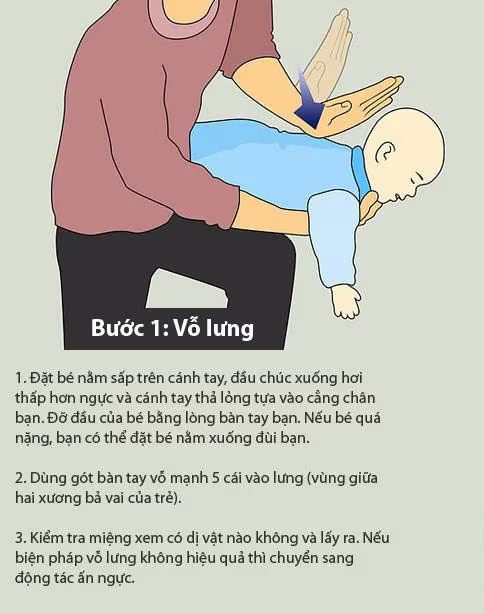 Báo động tình trạng hóc dị vật ở trẻ em ảnh 3 Báo động tình trạng hóc dị vật ở trẻ em ảnh 3