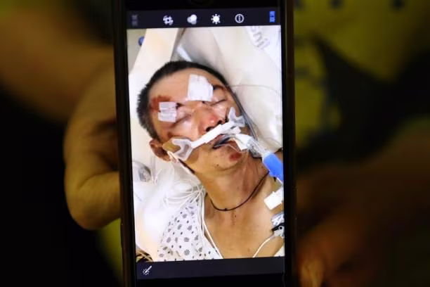 Nạn nhân Yao Pan Ma Nạn nhân Yao Pan Ma